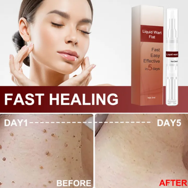 SkinClean - Tags & Moles Remover