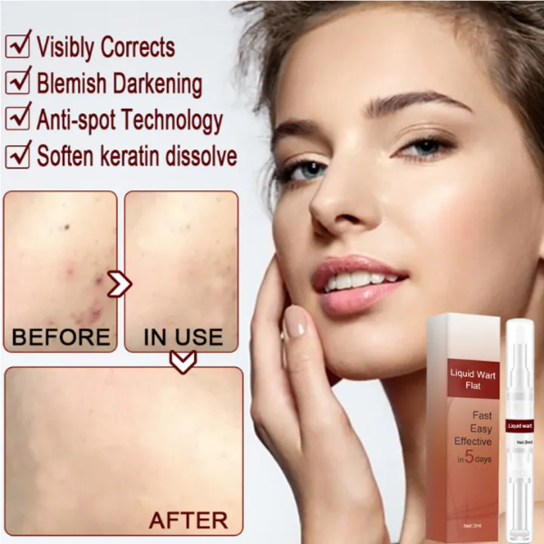 SkinClean - Tags & Moles Remover